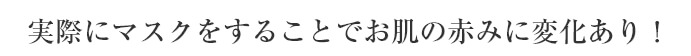 実際にマスクをすることでお肌の赤みに変化あり！