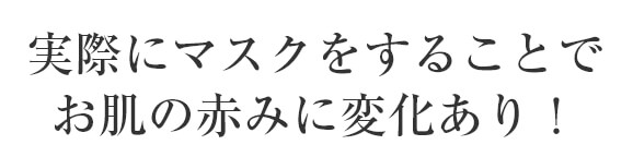 実際にマスクをすることでお肌の赤みに変化あり！